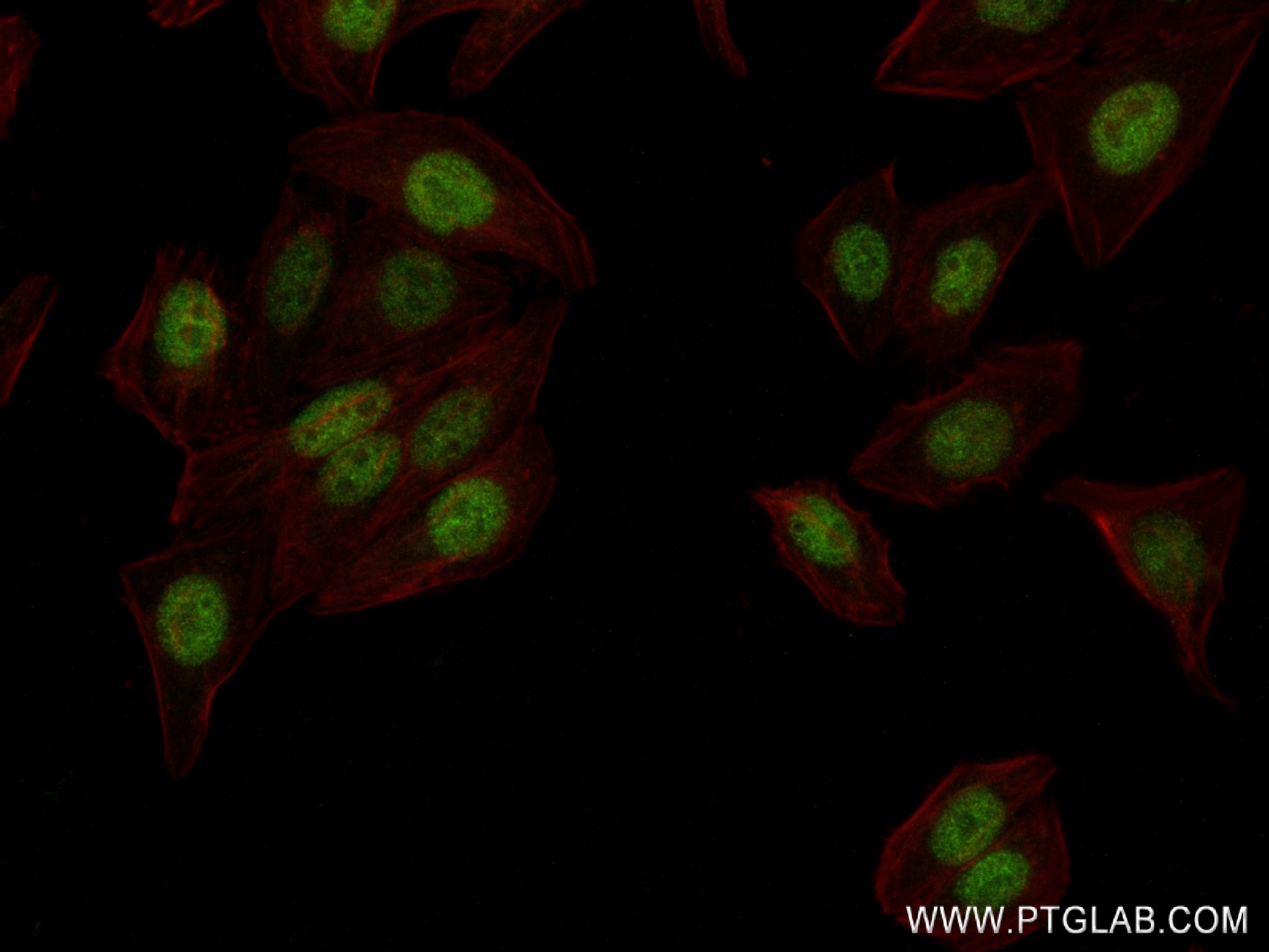 IF Staining of HepG2 using 83258-5-RR (same clone as 83258-5-PBS)