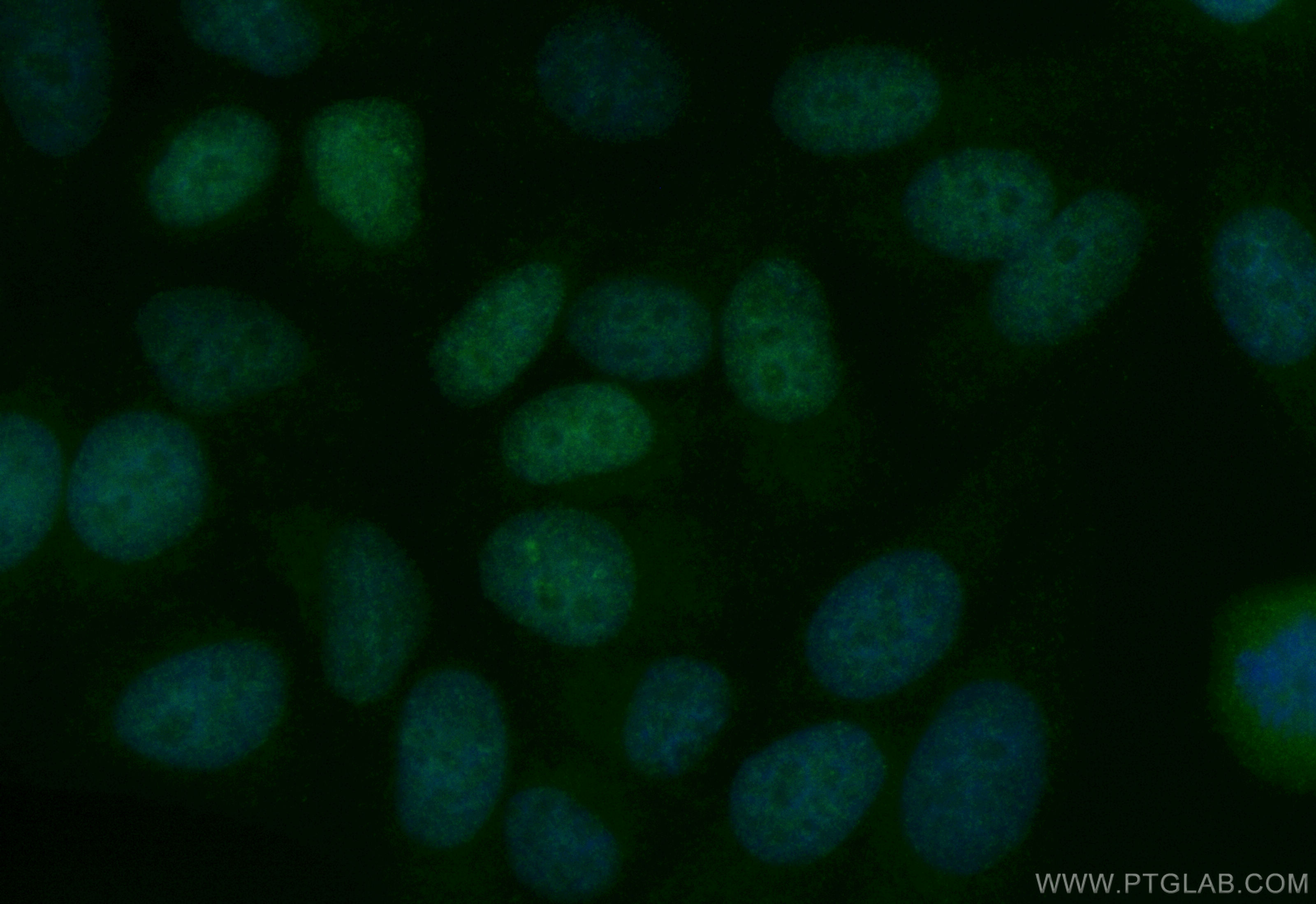 IF Staining of HepG2 using CL488-83258-6