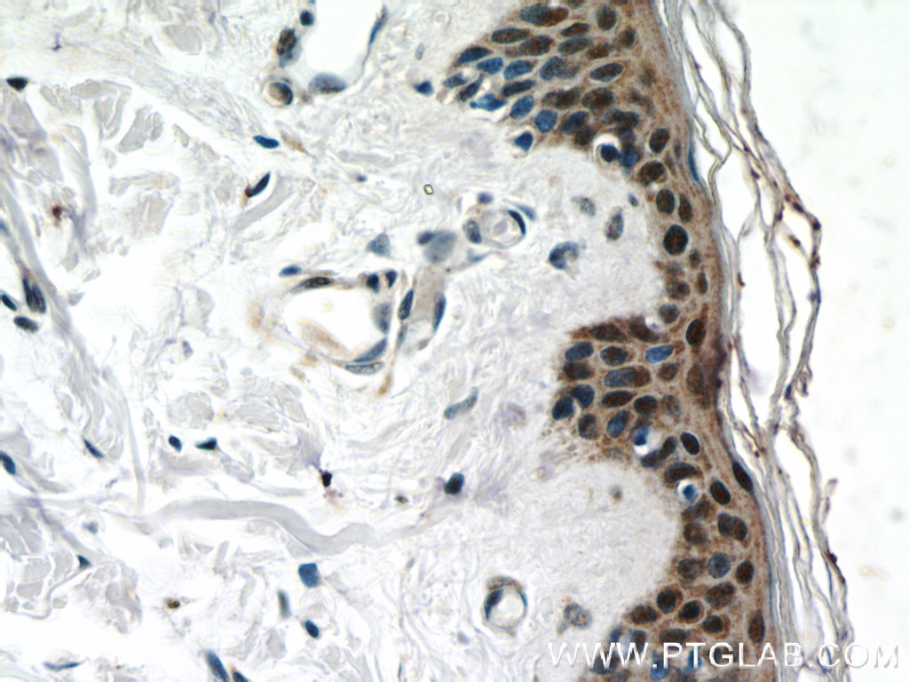 IHC staining of human skin using 23426-1-AP