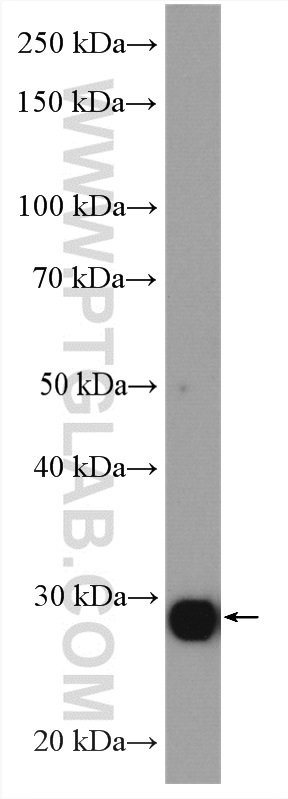 WB analysis of mouse liver using 26278-1-AP