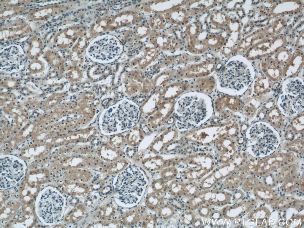 IHC staining of human kidney using 12239-1-AP