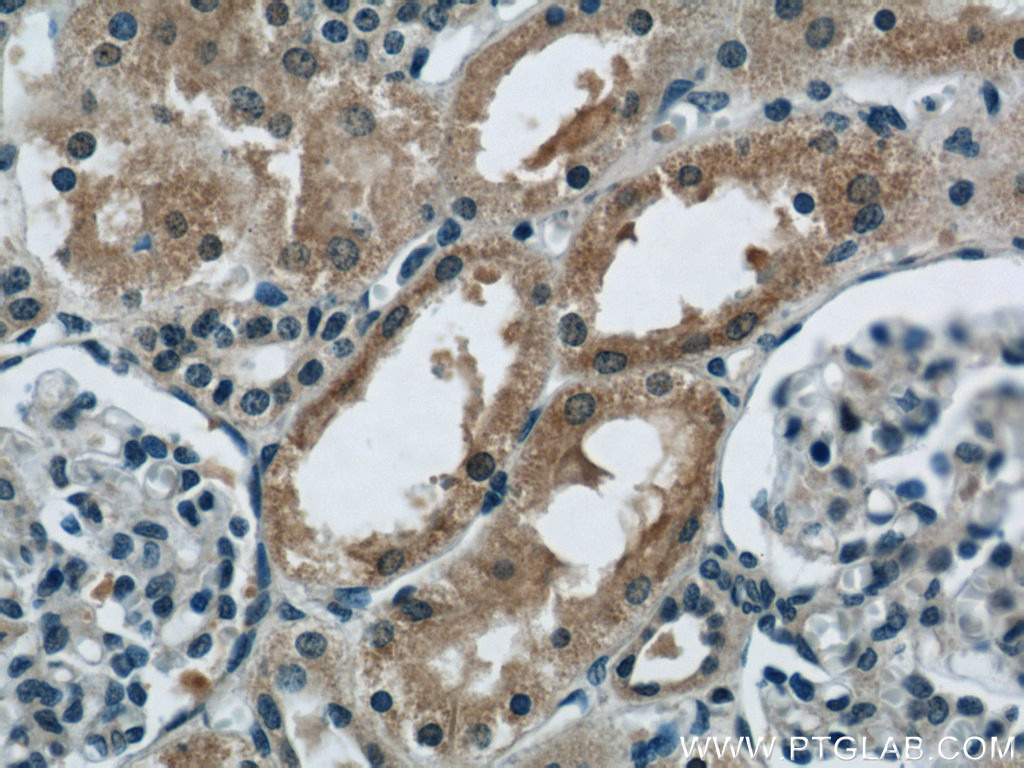 IHC staining of human kidney using 12239-1-AP