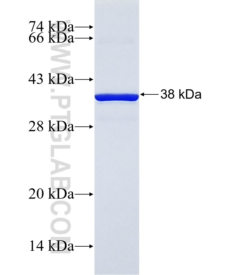 CBY3 fusion protein Ag31541 SDS-PAGE