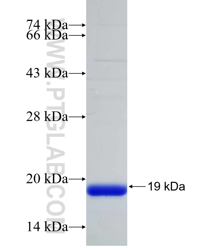 CBY3 fusion protein Ag31599 SDS-PAGE CBY3 fusion protein Ag31599 SDS-PAGE