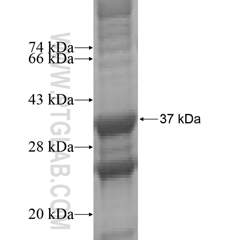 CC10 fusion protein Ag7913 SDS-PAGE CC10 fusion protein Ag7913 SDS-PAGE