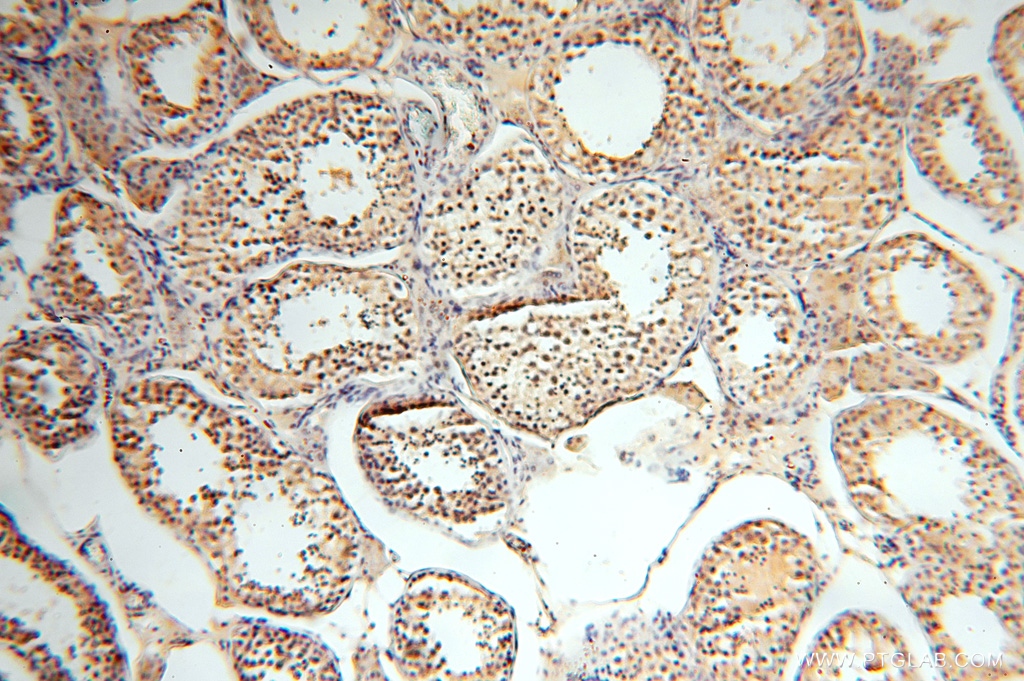 IHC staining of human testis using 16816-1-AP