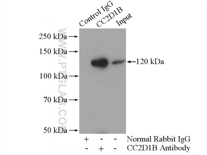 IP experiment of mouse brain using 20774-1-AP