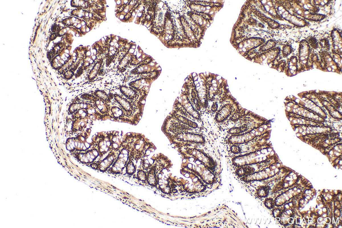 IHC staining of mouse colon using 25232-1-AP