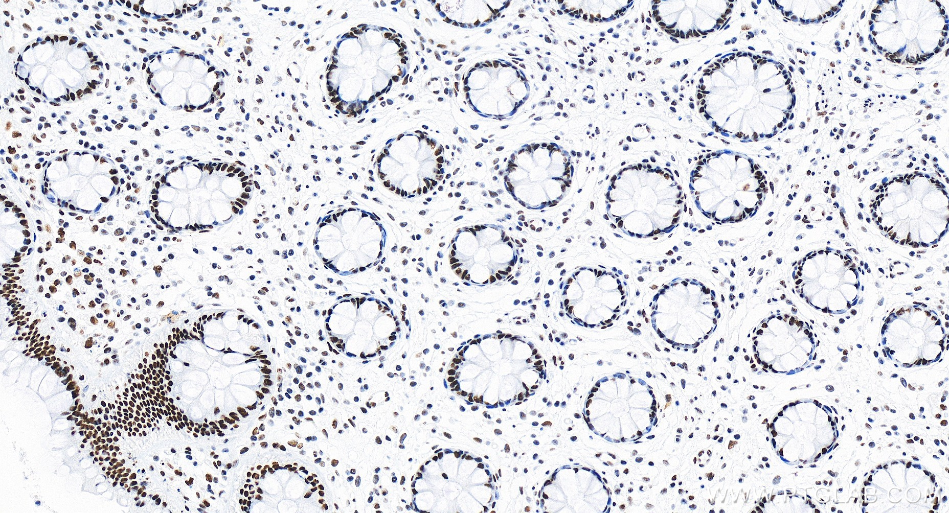 IHC staining of human colon using 83936-4-RR (same clone as 83936-4-PBS)