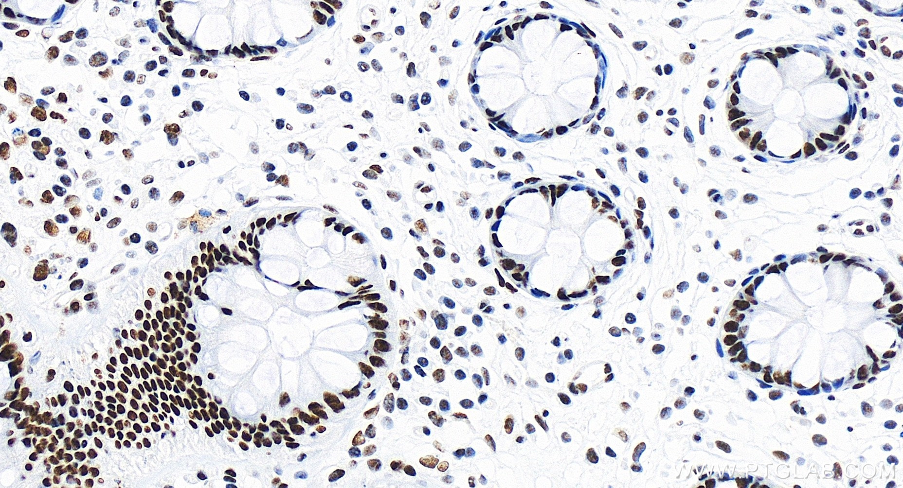 IHC staining of human colon using 83936-4-RR (same clone as 83936-4-PBS)