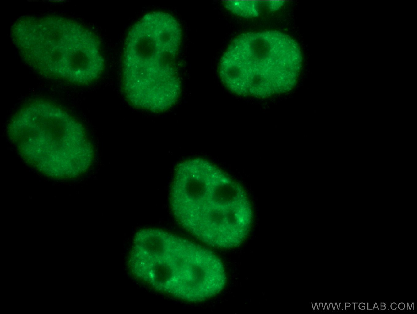 IF Staining of HeLa using 66497-1-Ig