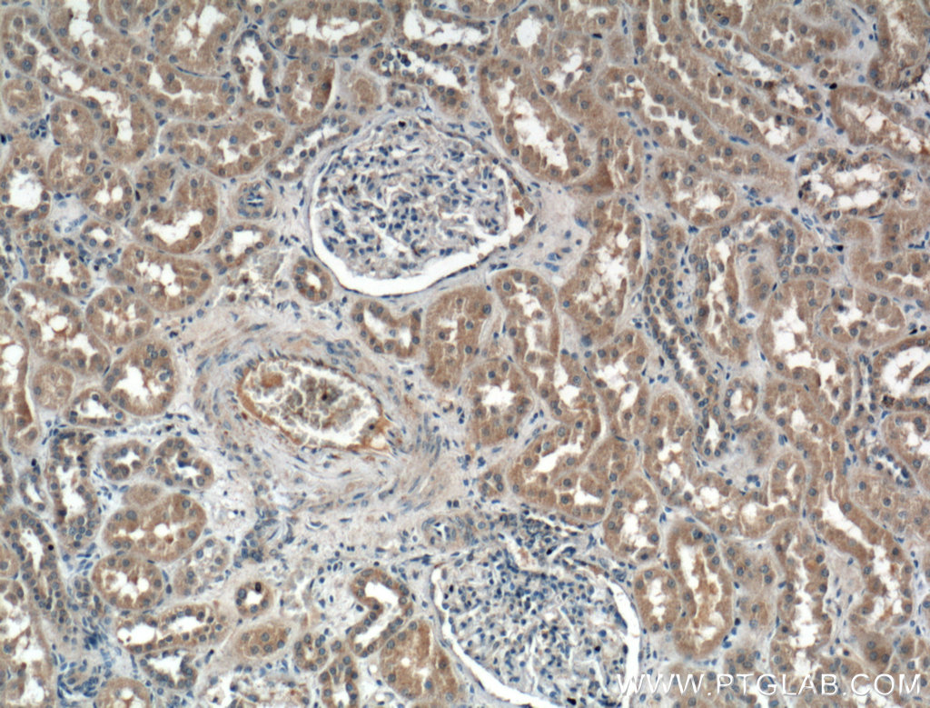 IHC staining of human kidney using 24449-1-AP