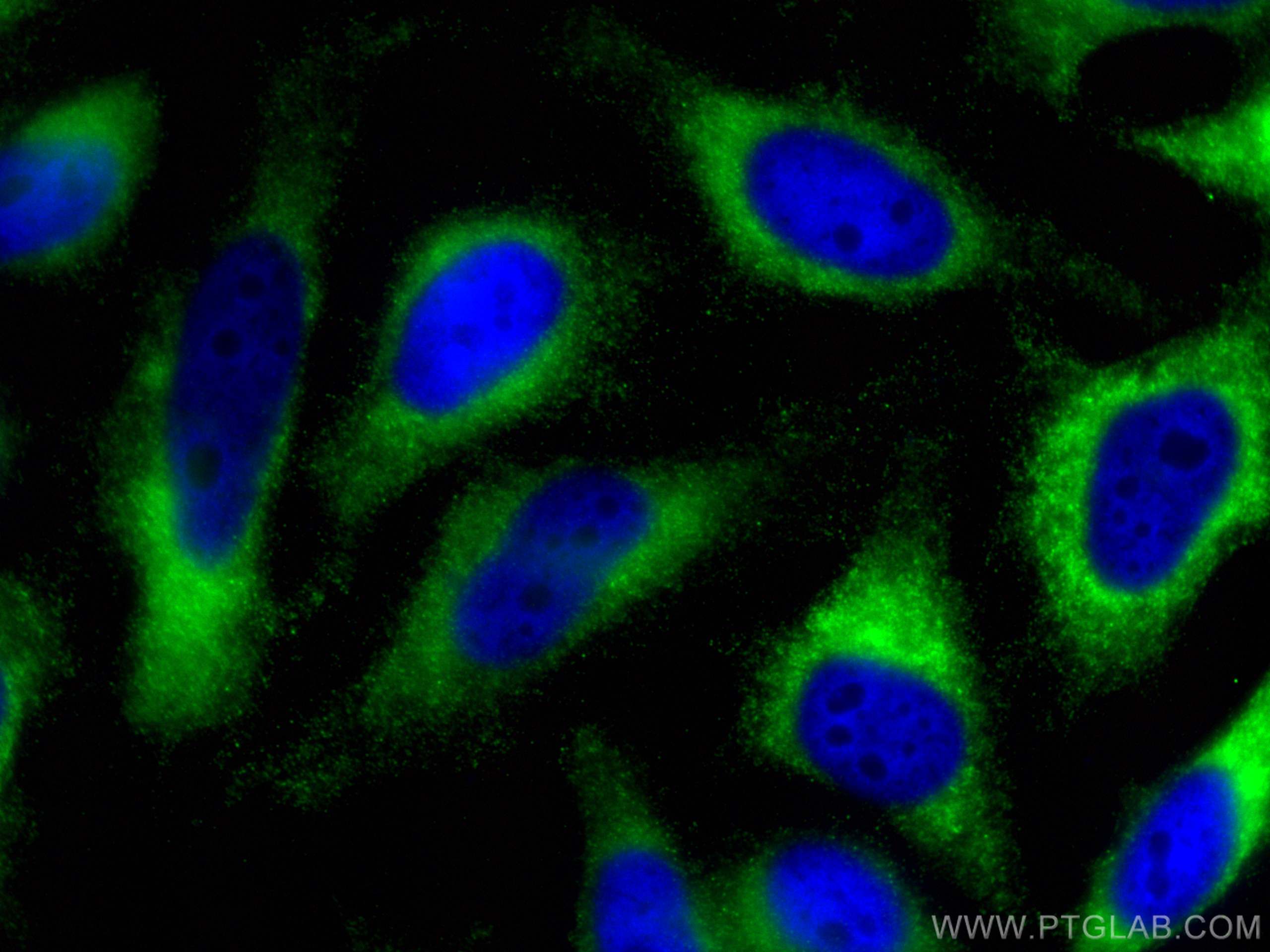 IF Staining of HeLa using 30296-1-AP