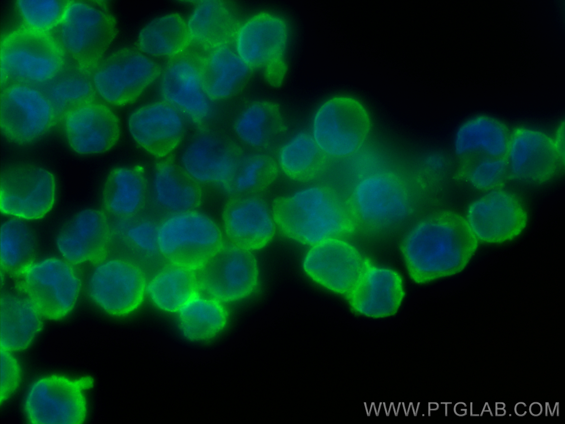 IF Staining of K-562 using 55476-1-AP