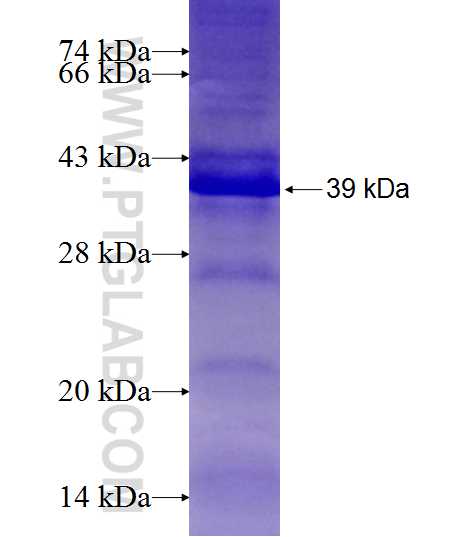 CCDC101 fusion protein Ag21269 SDS-PAGE