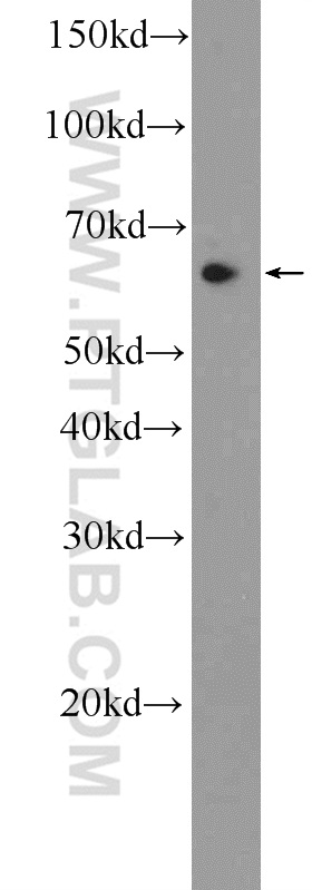 WB analysis of HeLa using 25764-1-AP