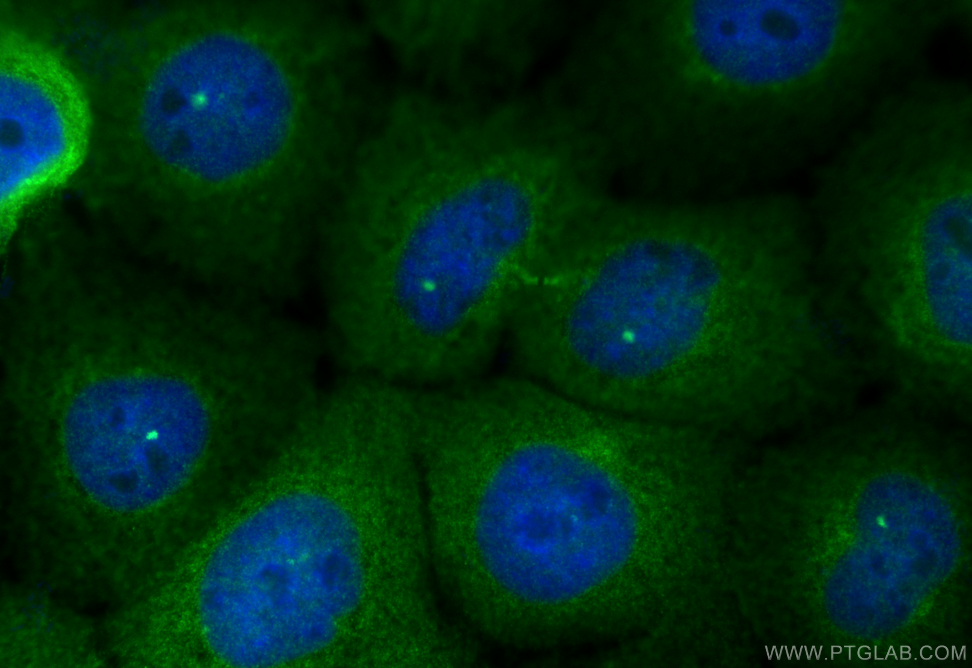 Immunofluorescent analysis of (4% PFA) fixed A431 cells using CCDC102B antibody (31675-1-AP) at dilution of 1:200 and Multi-rAb CoraLite ® Plus 488-Goat Anti-Rabbit Recombinant Secondary Antibody (H+L) (RGAR002). IF Staining of A431 using 31675-1-AP
