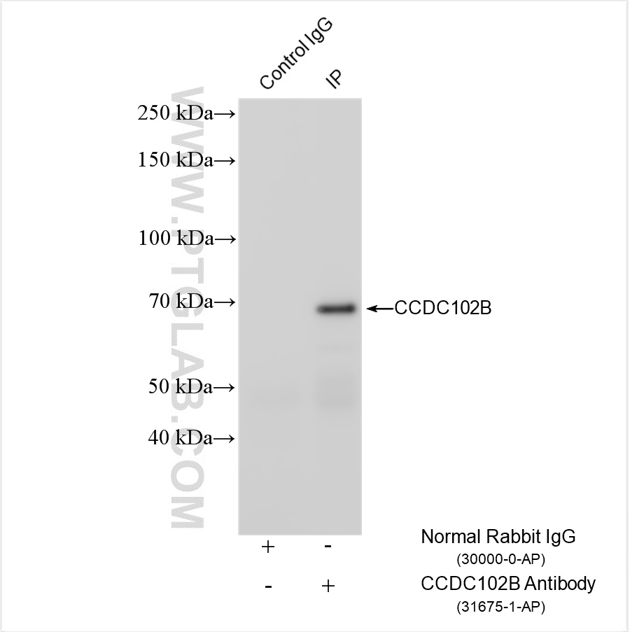 IP result of anti-CCDC102B (IP:31675-1-AP, 4ug; Detection:31675-1-AP 1:800) with SH-SY5Y cells lysate 1240 ug. IP experiment of SH-SY5Y using 31675-1-AP