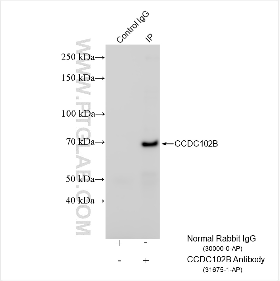 IP result of anti-CCDC102B (IP:31675-1-AP, 4ug; Detection:31675-1-AP 1:800) with MOLT-4 cells lysate 1800 ug. IP experiment of MOLT-4 using 31675-1-AP