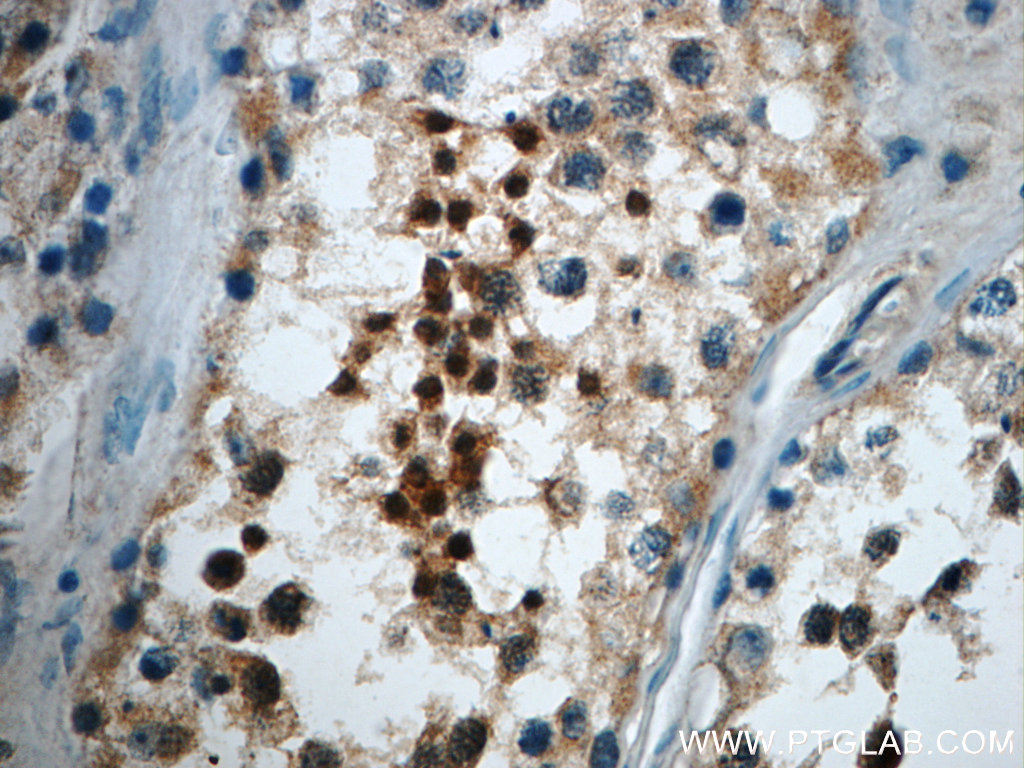 IHC staining of human testis using 24276-1-AP