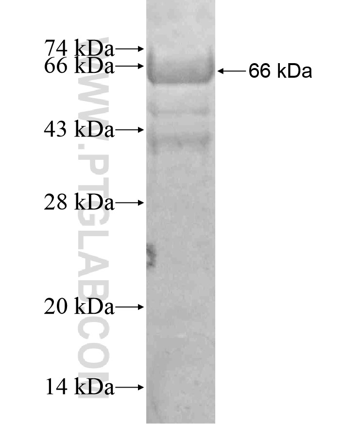 CCDC104 fusion protein Ag17996 SDS-PAGE