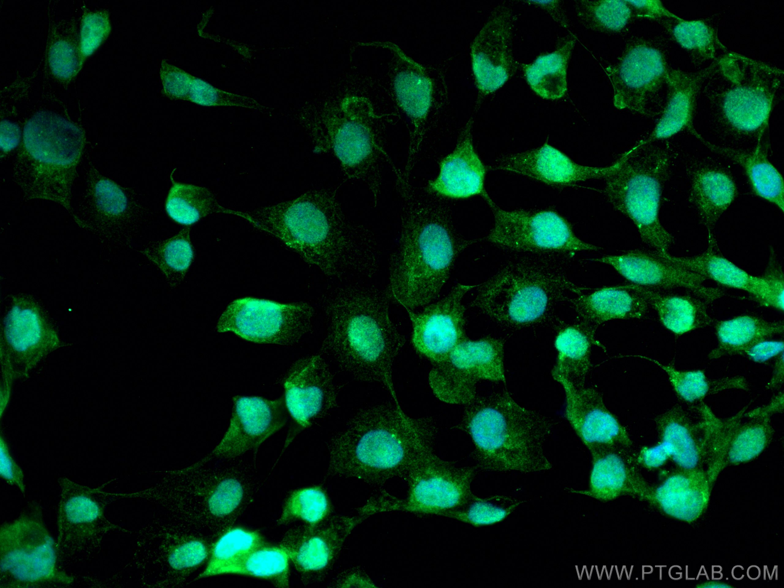 IF Staining of A431 using 29824-1-AP