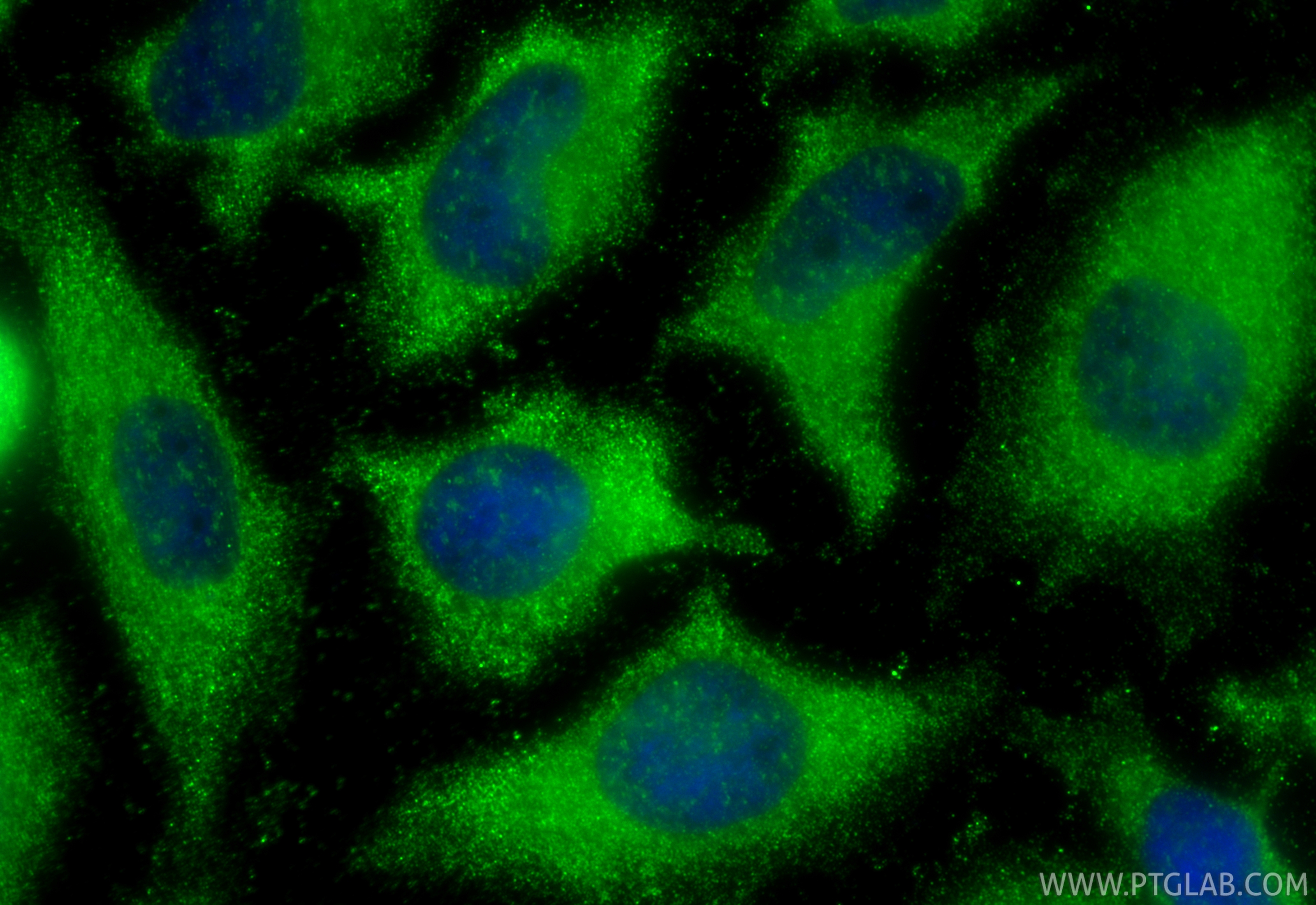 IF Staining of HeLa using 29824-1-AP