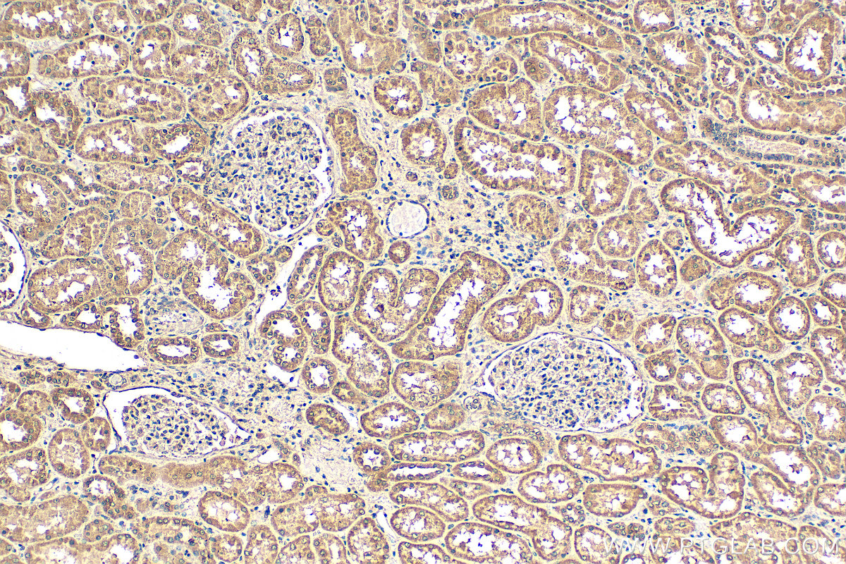 IHC staining of human kidney using 29824-1-AP