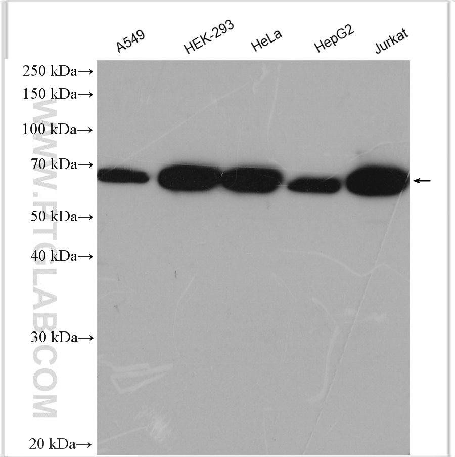 WB analysis using 29824-1-AP