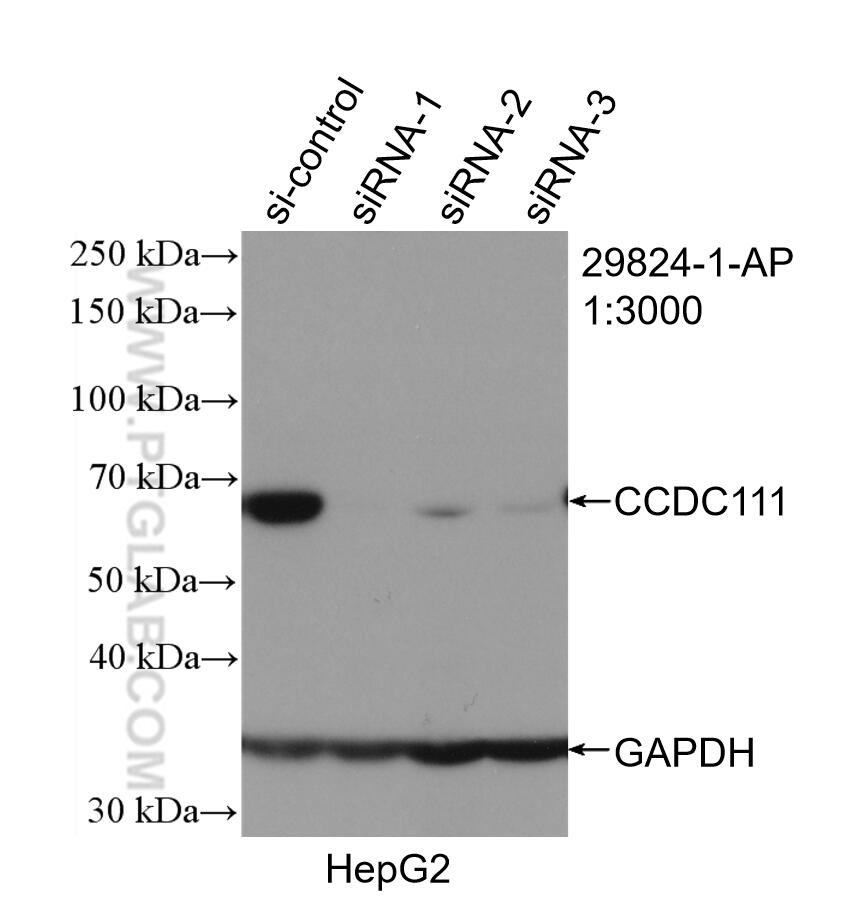 WB analysis of HepG2 using 29824-1-AP