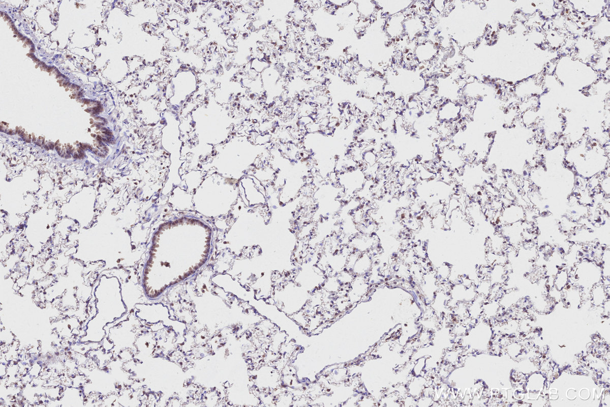 IHC staining of rat lung using 20636-1-AP IHC staining of rat lung using 20636-1-AP