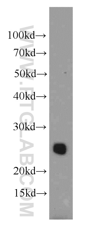 WB analysis of mouse brain using 20636-1-AP