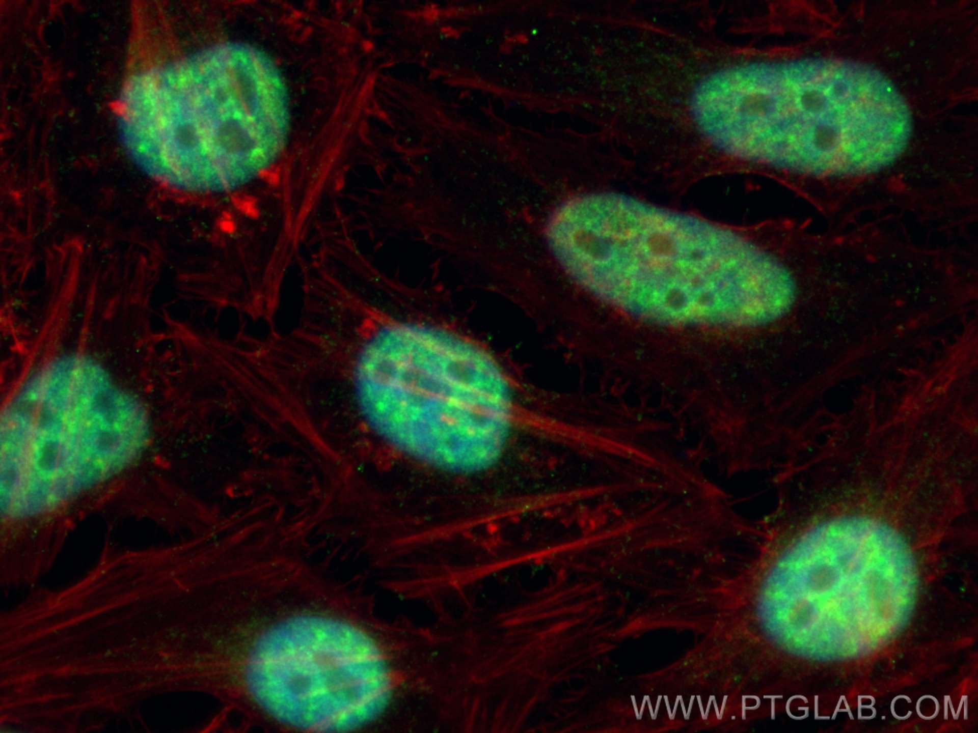 IF Staining of HeLa using 25138-1-AP