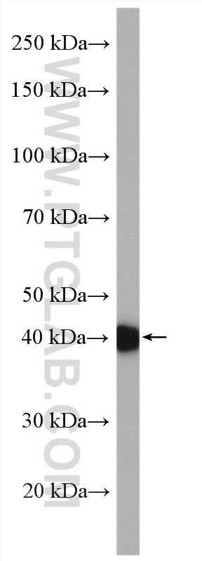 CEP89