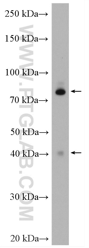 WB analysis of SH-SY5Y using 24002-1-AP