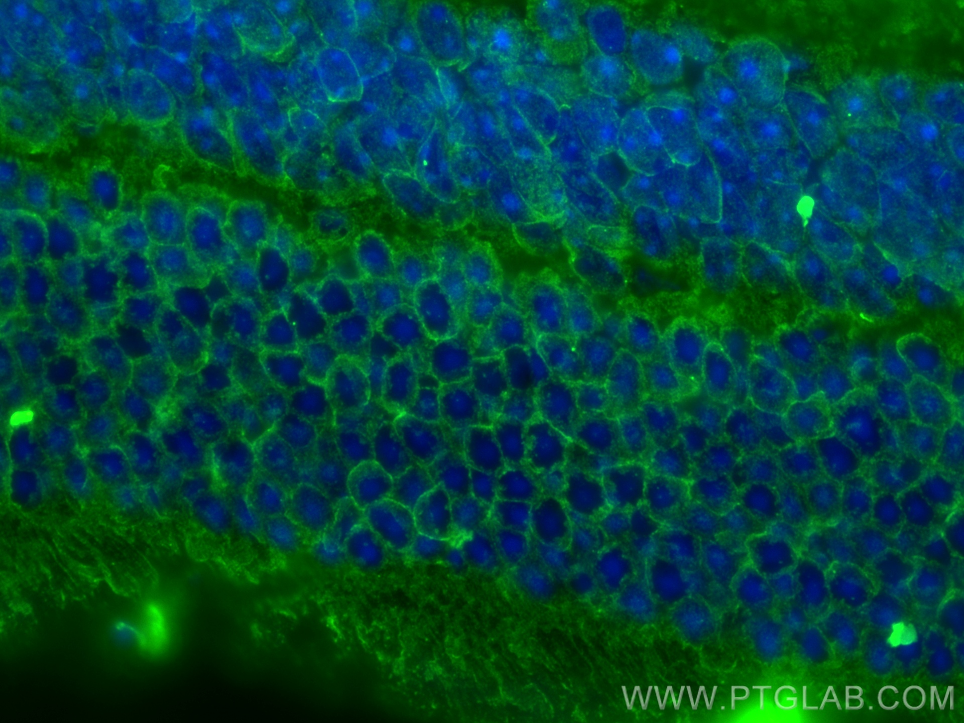 IF Staining of mouse eye using 68112-1-Ig (same clone as 68112-1-PBS)