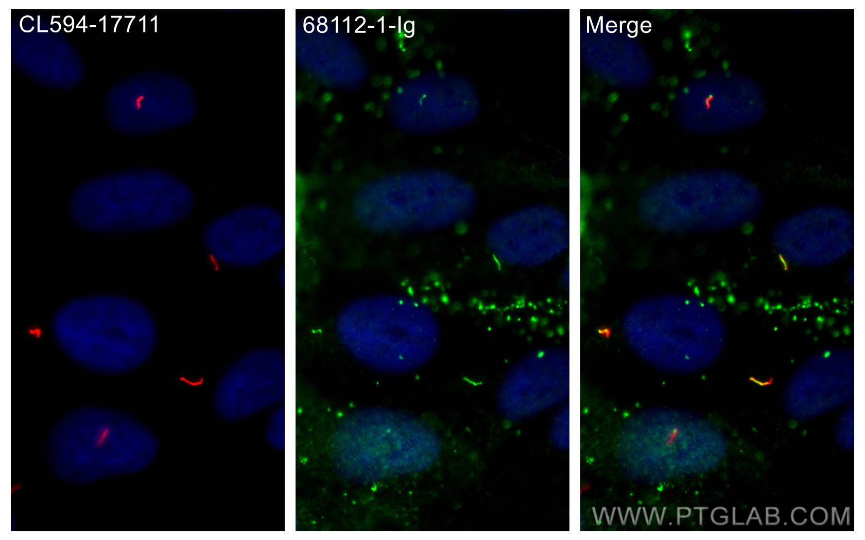 IF Staining of hTERT-RPE1 using 68112-1-Ig (same clone as 68112-1-PBS)