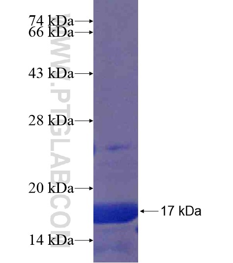 CCDC123 fusion protein Ag21214 SDS-PAGE CCDC123 fusion protein Ag21214 SDS-PAGE