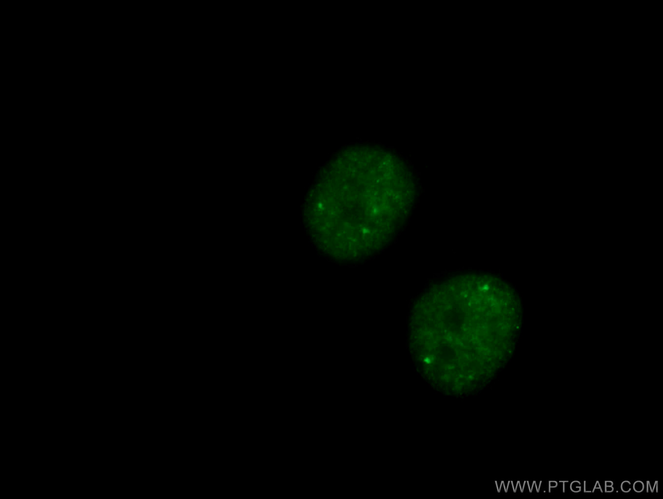 IF Staining of HeLa using 27106-1-AP