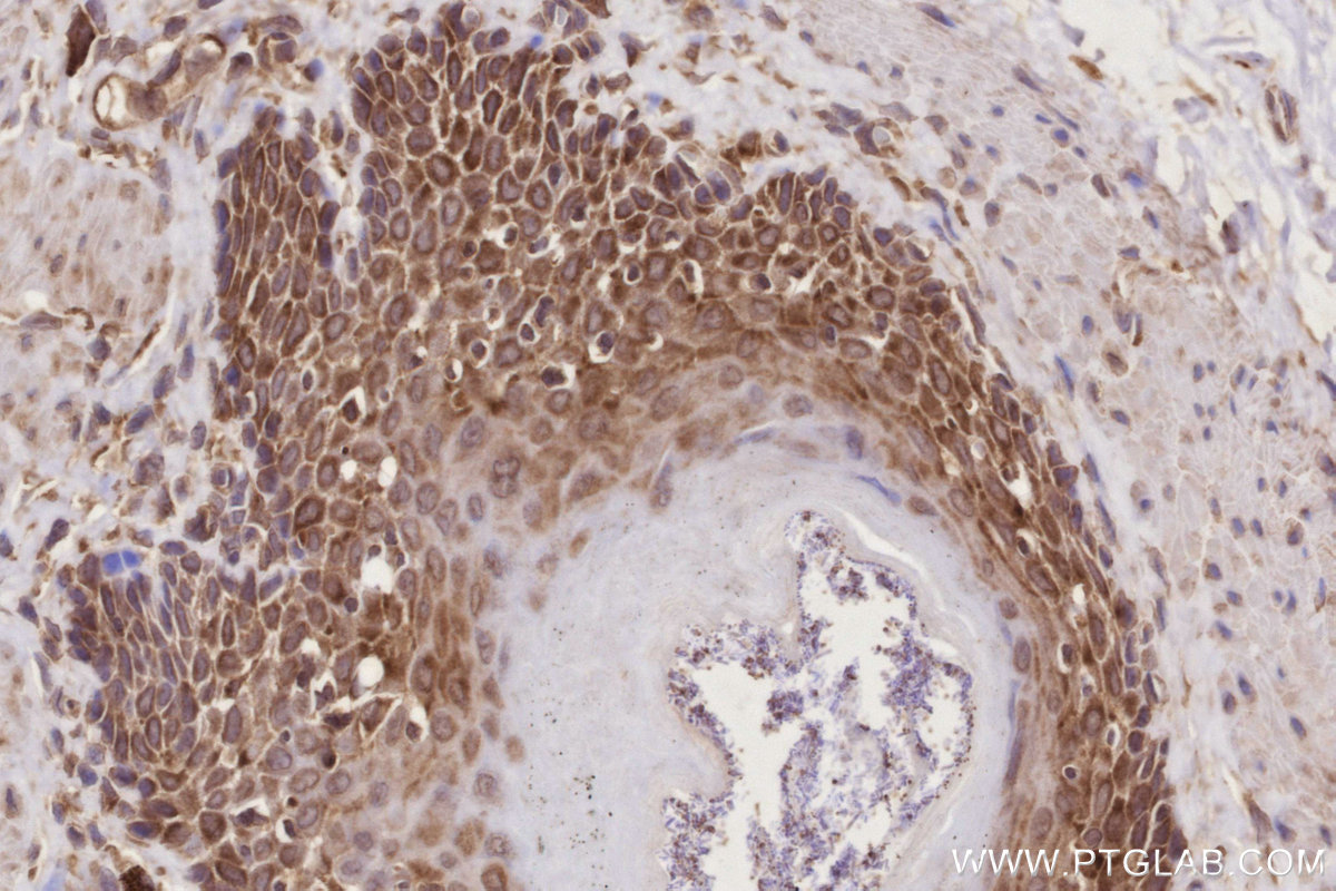 IHC staining of rat stomach using 27106-1-AP IHC staining of rat stomach using 27106-1-AP