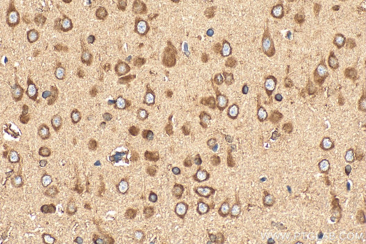 Immunohistochemical analysis of paraffin-embedded rat brain tissue slide using 27106-1-AP (CCDC124 antibody) at dilution of 1:200 (under 40x lens). Heat mediated antigen retrieval with Tris-EDTA buffer (pH 9.0). IHC staining of rat brain using 27106-1-AP