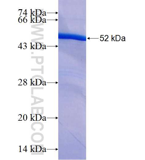 CCDC124 fusion protein Ag25930 SDS-PAGE