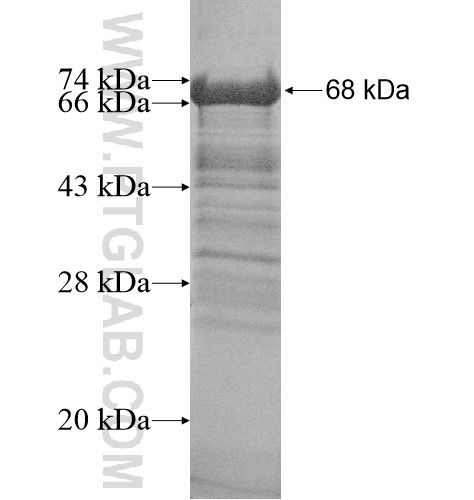 CCDC130 fusion protein Ag14396 SDS-PAGE CCDC130 fusion protein Ag14396 SDS-PAGE