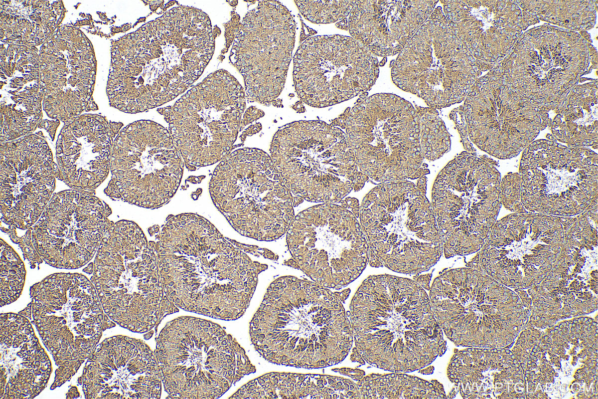 IHC staining of mouse testis using 21351-1-AP