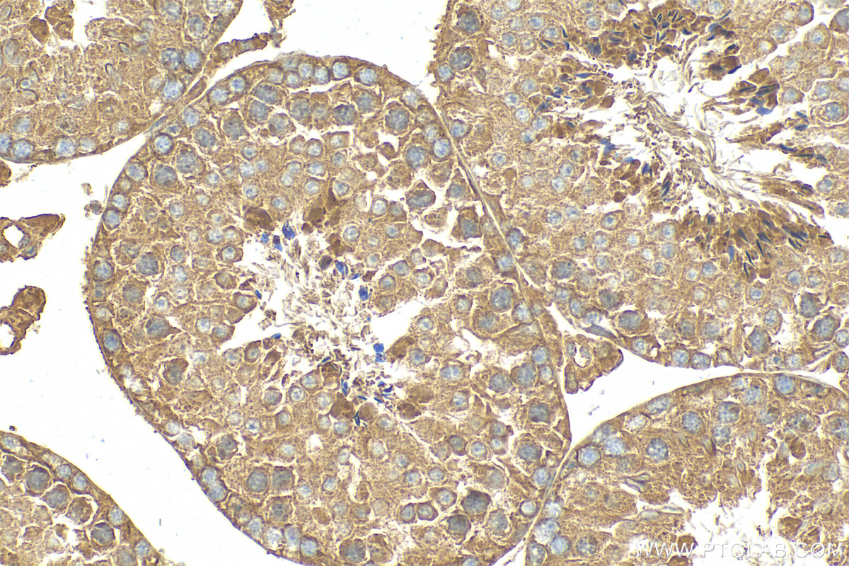 IHC staining of mouse testis using 21351-1-AP
