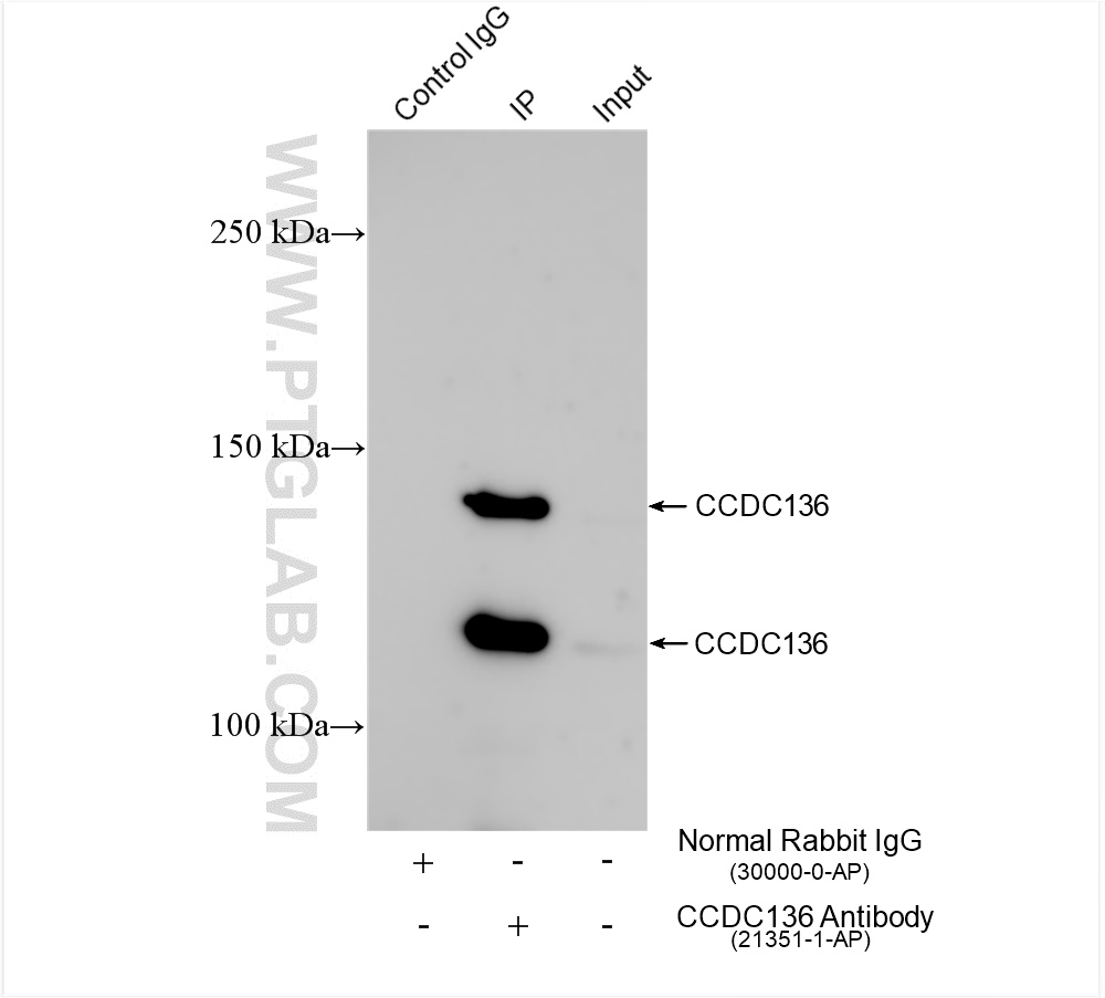 IP experiment of mouse testis using 21351-1-AP
