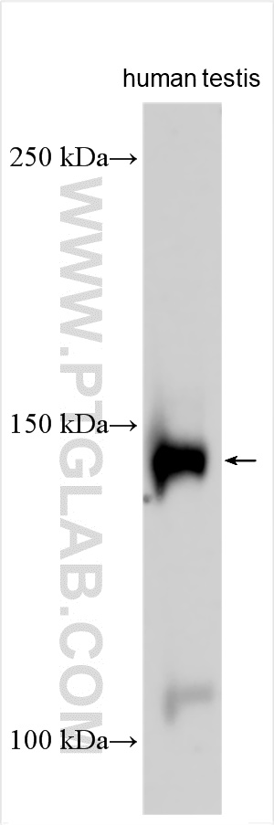 WB analysis using 21351-1-AP