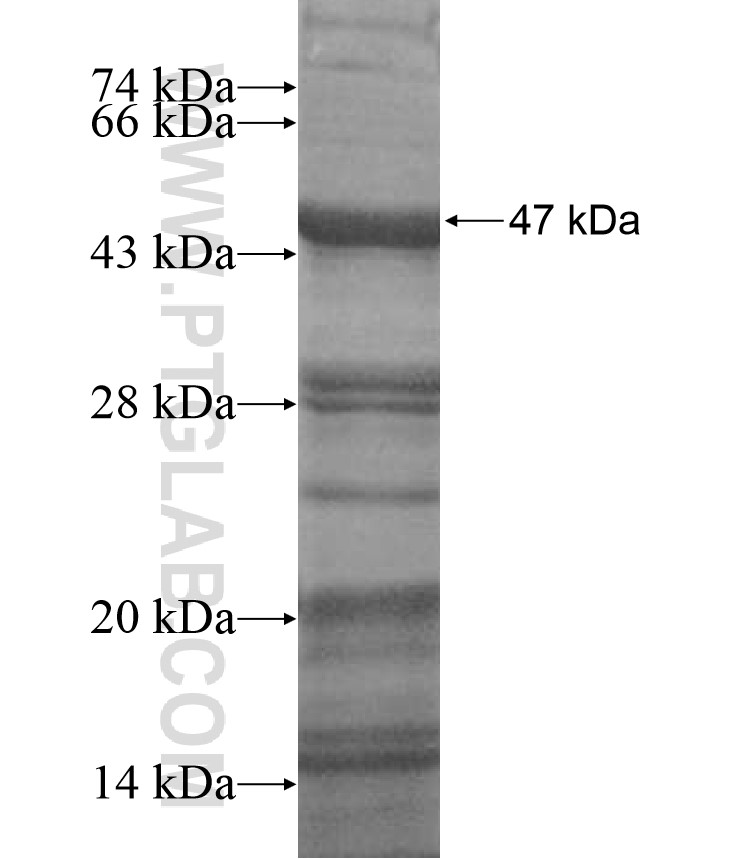 CCDC136 fusion protein Ag17199 SDS-PAGE CCDC136 fusion protein Ag17199 SDS-PAGE