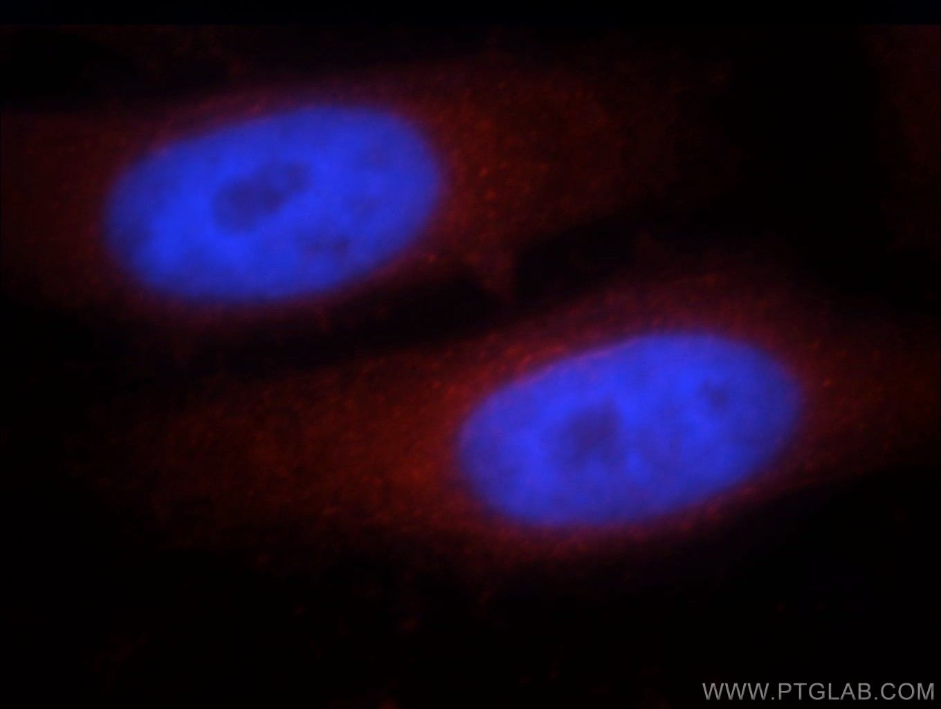 IF Staining of HepG2 using 21390-1-AP