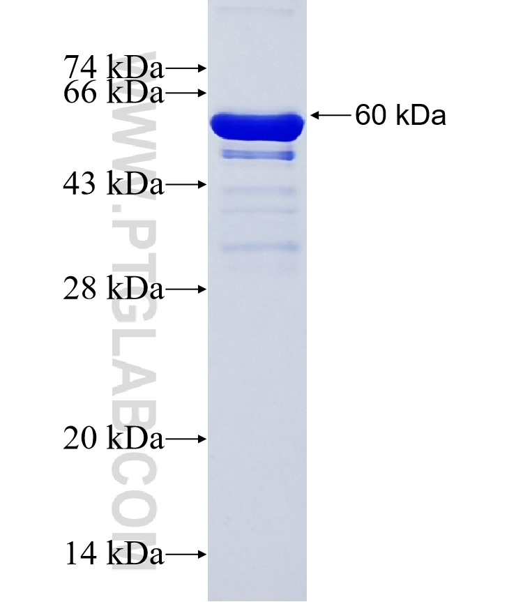 CCDC157 fusion protein Ag37002 SDS-PAGE